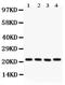 ATP Synthase Peripheral Stalk Subunit D antibody, PA5-78840, Invitrogen Antibodies, Western Blot image 