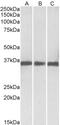 PNP antibody, 43-273, ProSci, Immunohistochemistry paraffin image 