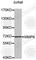 Matrix Metallopeptidase 9 antibody, A6170, ABclonal Technology, Western Blot image 