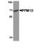 Protein Phosphatase, Mg2+/Mn2+ Dependent 1D antibody, TA349123, Origene, Western Blot image 