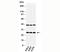 C-Type Lectin Domain Family 4 Member E antibody, orb248117, Biorbyt, Western Blot image 