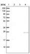 Chromosome 1 Open Reading Frame 68 antibody, NBP1-93557, Novus Biologicals, Western Blot image 