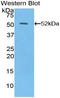 Interferon Beta 1 antibody, LS-B13915, Lifespan Biosciences, Western Blot image 