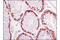 Piwi Like RNA-Mediated Gene Silencing 2 antibody, 5940S, Cell Signaling Technology, Immunohistochemistry paraffin image 