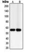 Thioredoxin Reductase 2 antibody, orb215002, Biorbyt, Western Blot image 