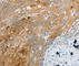 Endothelin Receptor Type B antibody, A2908, ABclonal Technology, Immunohistochemistry paraffin image 