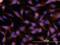 TNF Superfamily Member 12 antibody, PA5-47065, Invitrogen Antibodies, Immunocytochemistry image 