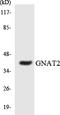 G Protein Subunit Alpha Transducin 2 antibody, LS-C291999, Lifespan Biosciences, Western Blot image 