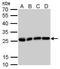 High Mobility Group Box 1 antibody, GTX629403, GeneTex, Western Blot image 
