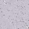 Alpha-N-Acetylgalactosaminidase antibody, HPA000649, Atlas Antibodies, Immunohistochemistry paraffin image 