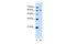 BMP2 Inducible Kinase antibody, GTX47013, GeneTex, Western Blot image 