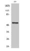 Cholinergic Receptor Nicotinic Alpha 5 Subunit antibody, STJ91448, St John