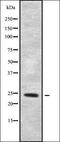 Cation Channel Sperm Associated 1 antibody, orb338145, Biorbyt, Western Blot image 