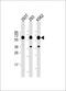 Lysine Methyltransferase 5A antibody, M05349-1, Boster Biological Technology, Western Blot image 