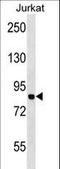 Minichromosome Maintenance Complex Component 7 antibody, LS-C164097, Lifespan Biosciences, Western Blot image 