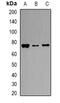 Transferrin antibody, abx142085, Abbexa, Western Blot image 