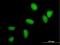 Ubiquitin-conjugating enzyme E2 C antibody, H00011065-M04, Novus Biologicals, Immunocytochemistry image 