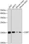 Chorionic Gonadotropin Subunit Beta 7 antibody, GTX66027, GeneTex, Western Blot image 