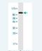 Actinin Alpha 4 antibody, H00000081-M15-100ug, Novus Biologicals, Western Blot image 