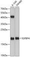 Insulin Like Growth Factor Binding Protein 4 antibody, GTX55672, GeneTex, Western Blot image 