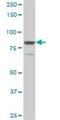 Transforming Acidic Coiled-Coil Containing Protein 3 antibody, H00010460-M02, Novus Biologicals, Western Blot image 