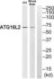 Autophagy Related 16 Like 2 antibody, LS-C824949, Lifespan Biosciences, Western Blot image 