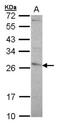 Glutathione S-Transferase Pi 1 antibody, NBP1-33627, Novus Biologicals, Western Blot image 