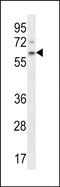 APC Down-Regulated 1 antibody, PA5-48559, Invitrogen Antibodies, Western Blot image 