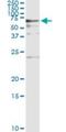 BAI1 Associated Protein 2 antibody, H00010458-M01, Novus Biologicals, Immunoprecipitation image 