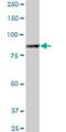 ALS2 C-Terminal Like antibody, H00259173-B01P, Novus Biologicals, Western Blot image 