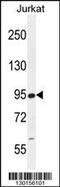 Round Spermatid Basic Protein 1 antibody, 55-902, ProSci, Western Blot image 