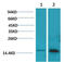 S100 Calcium Binding Protein A1 antibody, STJ97491, St John