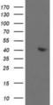 Aldolase, Fructose-Bisphosphate B antibody, NBP2-00750, Novus Biologicals, Western Blot image 