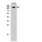 Protein Tyrosine Kinase 2 antibody, LS-C383464, Lifespan Biosciences, Western Blot image 