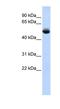 Translocation Associated Membrane Protein 1 Like 1 antibody, NBP1-60111, Novus Biologicals, Western Blot image 