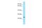 Divergent-Paired Related Homeobox antibody, PA5-70783, Invitrogen Antibodies, Western Blot image 