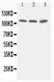 Tight Junction Protein 3 antibody, LS-C313104, Lifespan Biosciences, Western Blot image 