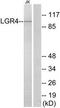 Leucine Rich Repeat Containing G Protein-Coupled Receptor 4 antibody, TA312695, Origene, Western Blot image 