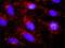 Catenin alpha-3 antibody, H00029119-D01P, Novus Biologicals, Proximity Ligation Assay image 