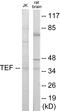 TEF Transcription Factor, PAR BZIP Family Member antibody, EKC1784, Boster Biological Technology, Western Blot image 