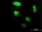Zinc Finger Protein 213 antibody, H00007760-M02, Novus Biologicals, Immunofluorescence image 