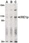 Endoplasmic Reticulum To Nucleus Signaling 1 antibody, PA5-20190, Invitrogen Antibodies, Western Blot image 