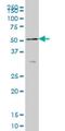 SH3 Domain Containing Ring Finger 2 antibody, H00153769-M01, Novus Biologicals, Western Blot image 
