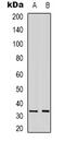 mAR-1 antibody, abx133776, Abbexa, Western Blot image 