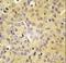 Leucyl-TRNA Synthetase antibody, LS-C100610, Lifespan Biosciences, Immunohistochemistry paraffin image 