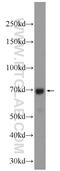 MSL Complex Subunit 1 antibody, 24373-1-AP, Proteintech Group, Western Blot image 