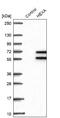 Hexosaminidase Subunit Alpha antibody, NBP2-30997, Novus Biologicals, Western Blot image 