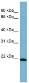 TIR Domain Containing Adaptor Protein antibody, TA338811, Origene, Western Blot image 