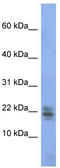 Ribonuclease A Family Member 1, Pancreatic antibody, TA345820, Origene, Western Blot image 