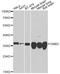 G Protein Subunit Beta 2 antibody, STJ110720, St John